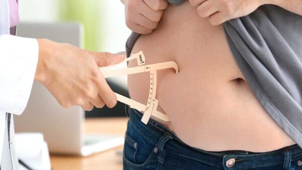 doctor measuring belly fat of patient