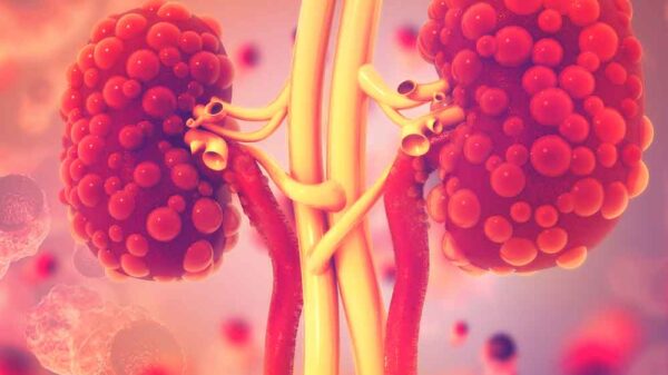 3d ilustration of kidney disease