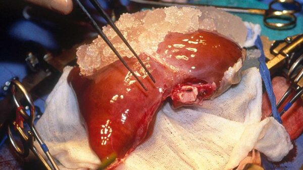 operating human liver