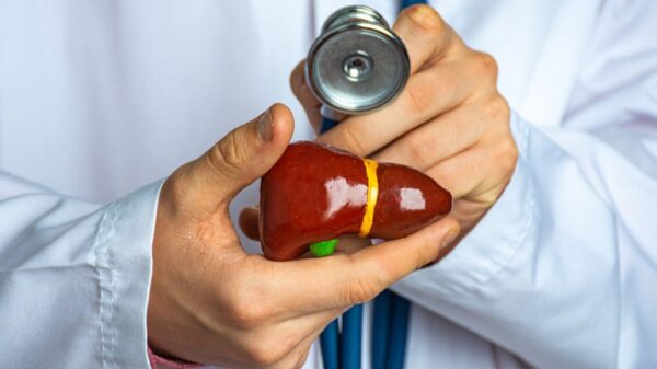 Doctor holding a human liver model