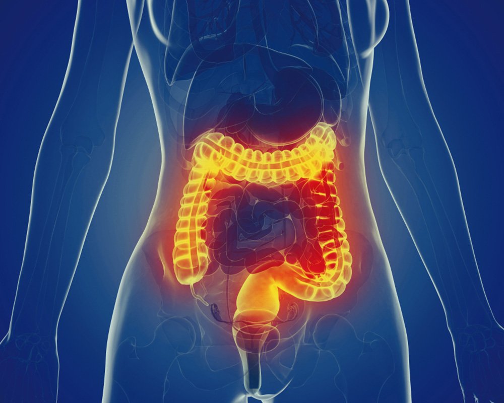 How can I treat diverticulitis at home?